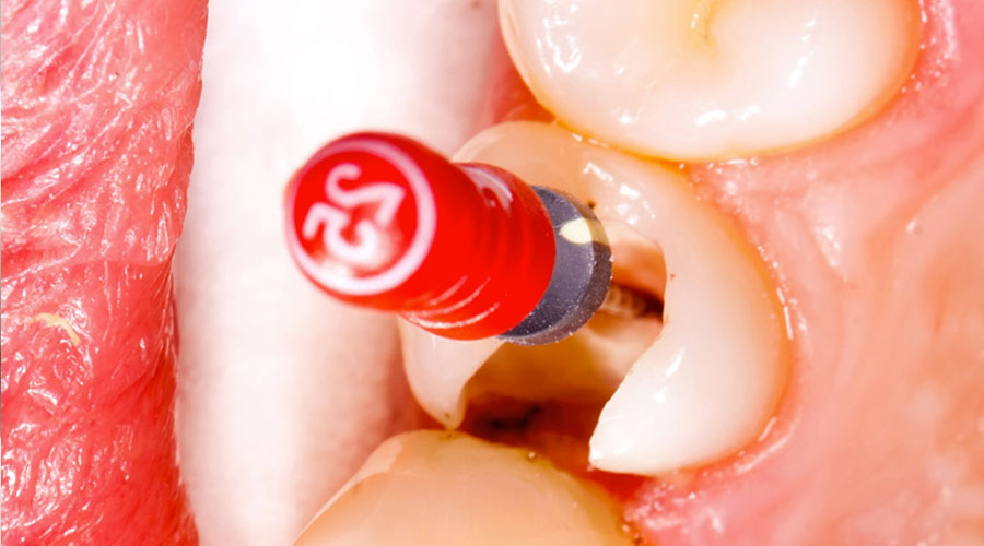 Endodontie