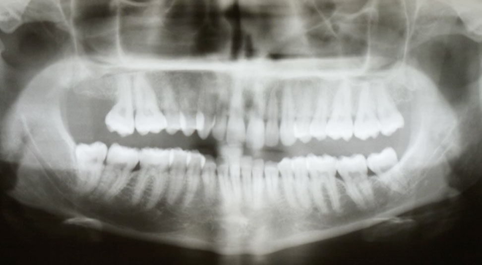 radiographie